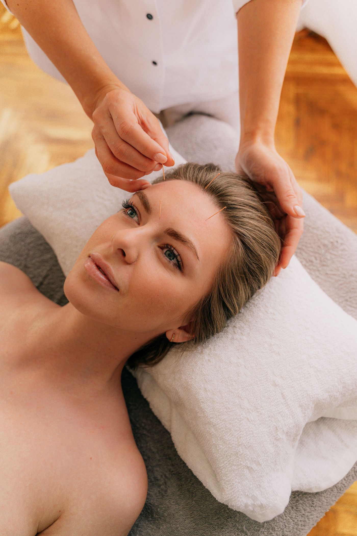 針灸療程